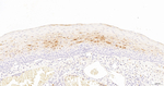 SERPINB3 Antibody in Immunohistochemistry (Paraffin) (IHC (P))