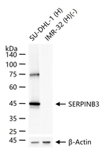 SERPINB3 Antibody in Western Blot (WB)