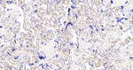 FCGR2B Monoclonal Antibody (4A11)