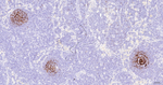 CD23 Antibody in Immunohistochemistry (Paraffin) (IHC (P))