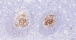 CD23 Antibody in Immunohistochemistry (Paraffin) (IHC (P))