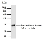 NGAL Monoclonal Antibody (4H11)