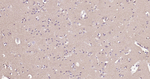 CD90 Antibody in Immunohistochemistry (Paraffin) (IHC (P))