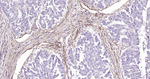 CD90 Antibody in Immunohistochemistry (Paraffin) (IHC (P))