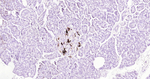 Osteopontin Antibody in Immunohistochemistry (Paraffin) (IHC (P))