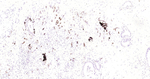 Osteopontin Antibody in Immunohistochemistry (Paraffin) (IHC (P))