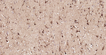 Osteopontin Antibody in Immunohistochemistry (Paraffin) (IHC (P))
