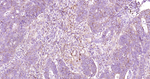 Osteopontin Antibody in Immunohistochemistry (Paraffin) (IHC (P))