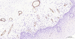P-Selectin Antibody in Immunohistochemistry (Paraffin) (IHC (P))