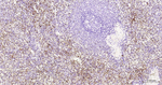 P-Selectin Antibody in Immunohistochemistry (Paraffin) (IHC (P))