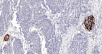 NGFR Monoclonal Antibody (7G1)