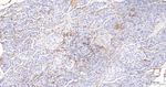 NGFR Antibody in Immunohistochemistry (Paraffin) (IHC (P))