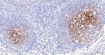 NGFR Antibody in Immunohistochemistry (Paraffin) (IHC (P))