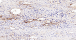 NGFR Antibody in Immunohistochemistry (Paraffin) (IHC (P))