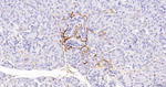 NGFR Antibody in Immunohistochemistry (Paraffin) (IHC (P))