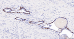 NGFR Antibody in Immunohistochemistry (Paraffin) (IHC (P))