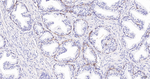 NGFR Recombinant Rabbit Monoclonal Antibody (7G1)