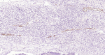 E-selectin Antibody in Immunohistochemistry (Paraffin) (IHC (P))