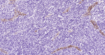 E-selectin Antibody in Immunohistochemistry (Paraffin) (IHC (P))