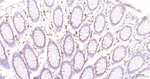 CD138 Antibody in Immunohistochemistry (Paraffin) (IHC (P))