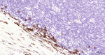 CD138 Antibody in Immunohistochemistry (Paraffin) (IHC (P))