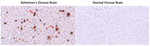 Amyloid beta 42 Antibody in Immunohistochemistry (Paraffin) (IHC (P))