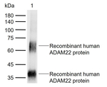 ADAM22 Monoclonal Antibody (10C3)