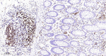 HLA-DRA Antibody in Immunohistochemistry (Paraffin) (IHC (P))