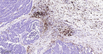 HLA-DRA Antibody in Immunohistochemistry (Paraffin) (IHC (P))