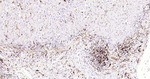 HLA-DRA Antibody in Immunohistochemistry (Paraffin) (IHC (P))