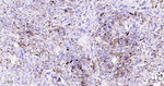 HLA-DRA Antibody in Immunohistochemistry (Paraffin) (IHC (P))