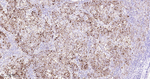 HLA-DRA Antibody in Immunohistochemistry (Paraffin) (IHC (P))
