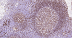 HLA-DRA Antibody in Immunohistochemistry (Paraffin) (IHC (P))