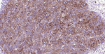 FASN Antibody in Immunohistochemistry (Paraffin) (IHC (P))
