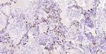 FASN Antibody in Immunohistochemistry (Paraffin) (IHC (P))