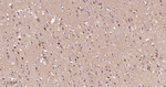 PIN1 Antibody in Immunohistochemistry (Paraffin) (IHC (P))