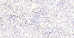 CD73 Antibody in Immunohistochemistry (Paraffin) (IHC (P))