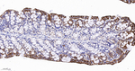E-cadherin Antibody in Immunohistochemistry (Paraffin) (IHC (P))