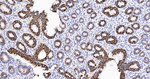 E-cadherin Antibody in Immunohistochemistry (Paraffin) (IHC (P))