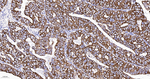 E-cadherin Antibody in Immunohistochemistry (Paraffin) (IHC (P))