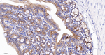 E-cadherin Antibody in Immunohistochemistry (Paraffin) (IHC (P))