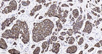 E-cadherin Antibody in Immunohistochemistry (Paraffin) (IHC (P))