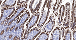 E-cadherin Antibody in Immunohistochemistry (Paraffin) (IHC (P))