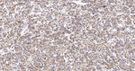 E-cadherin Antibody in Immunohistochemistry (Paraffin) (IHC (P))