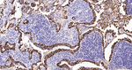 E-cadherin Antibody in Immunohistochemistry (Paraffin) (IHC (P))