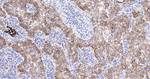 E-cadherin Antibody in Immunohistochemistry (Paraffin) (IHC (P))