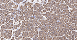E-cadherin Antibody in Immunohistochemistry (Paraffin) (IHC (P))