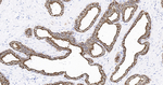 E-cadherin Antibody in Immunohistochemistry (Paraffin) (IHC (P))