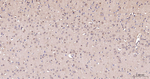 PGK1 Antibody in Immunohistochemistry (Paraffin) (IHC (P))