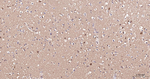 PGK1 Antibody in Immunohistochemistry (Paraffin) (IHC (P))
